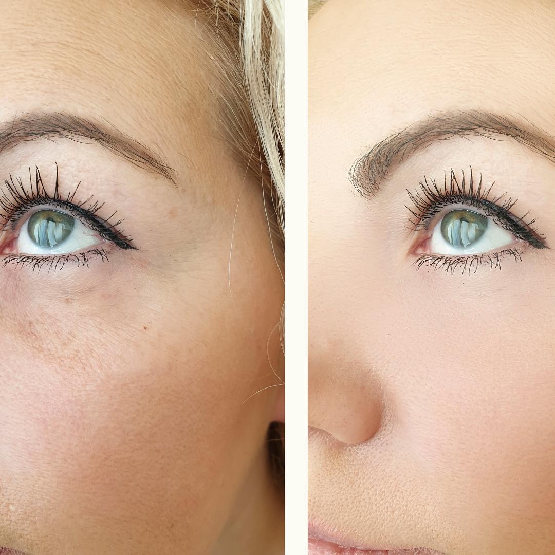 Olera Botox Serum