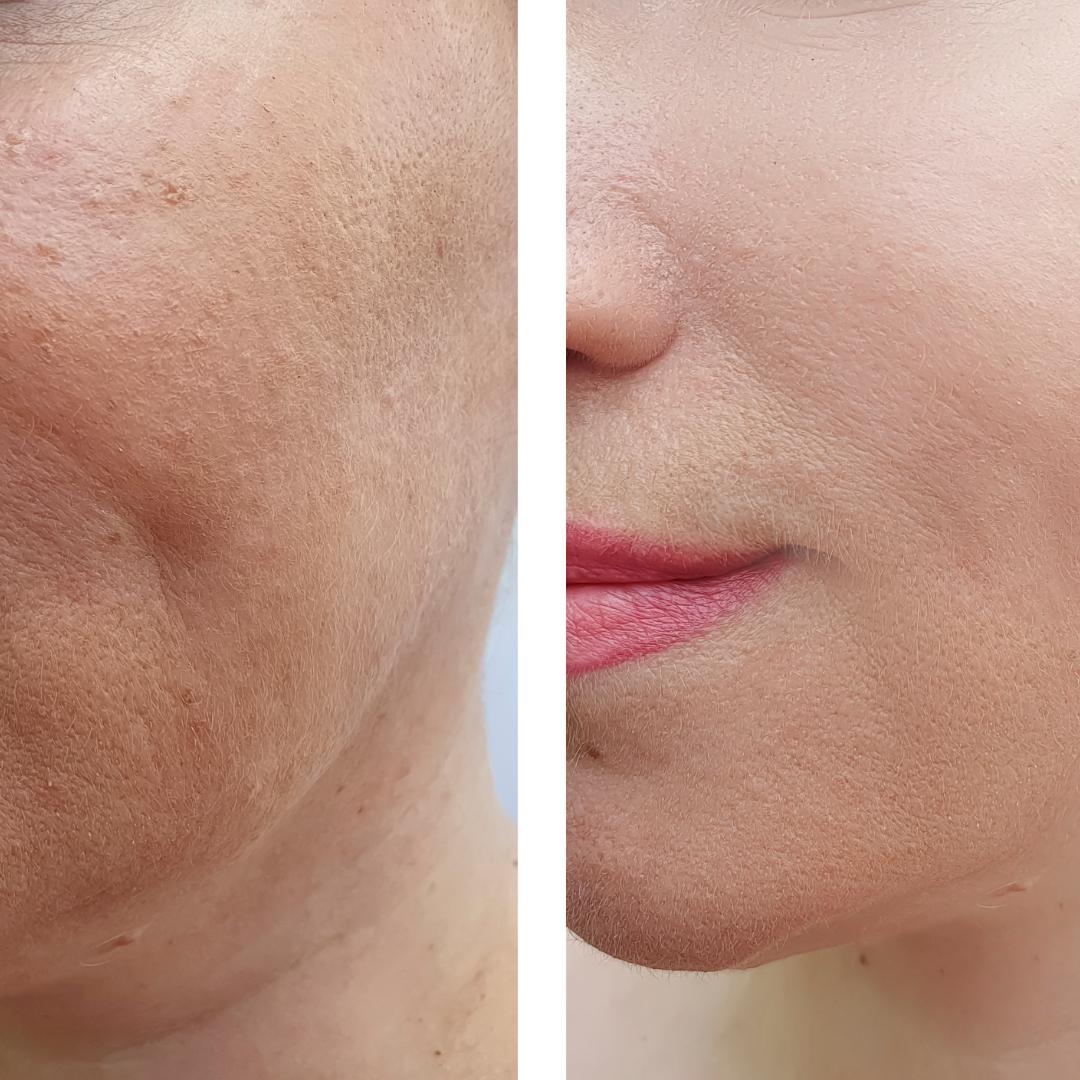 Olera Botox Serum