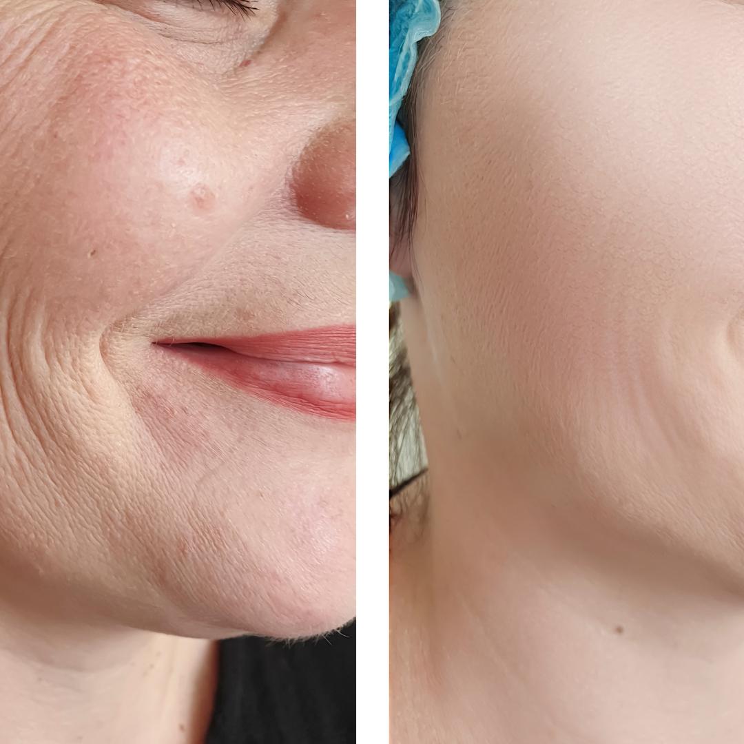 Olera Botox Serum
