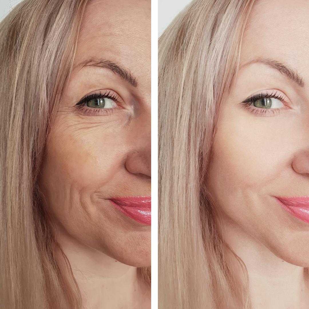 Olera Botox Serum